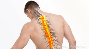 Juneau thoracic spine pain image