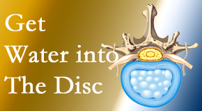 Aurora Chiropractic Center uses spinal manipulation and exercise to boost the diffusion of water into the disc which helps the health of the disc.
