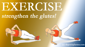 Aurora Chiropractic Center determines which muscles – like the gluteus max and medius - are weak for back pain sufferers and which exercises best help strengthen them.