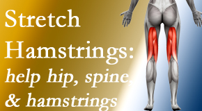 Aurora Chiropractic Center promotes back pain patients to stretch hamstrings for length, range of motion and flexibility to support the spine.