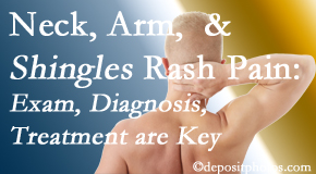 Aurora Chiropractic Center starts with a diagnosis, develops a treatment, and gets pain-relief results even in unusual conditions like neck pain, arm pain and a shingles rash!