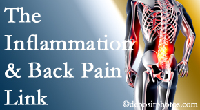 Aurora Chiropractic Center tackles the inflammatory process that accompanies back pain as well as the pain itself.