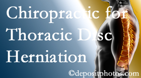 Aurora Chiropractic Center diagnoses and manages thoracic disc herniation pain and relieves its symptoms like unexplained abdominal pain or other gastrointestinal issues. 