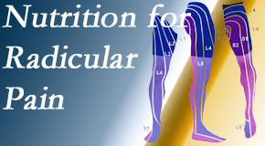 Juneau chiropractic nutrition advice for radicular pain