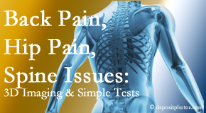 Aurora Chiropractic Center examines back pain patients for a variety of issues like back pain and hip pain and other spine issues with imaging and clinical tests that influence a relieving chiropractic treatment plan.