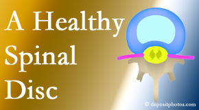 Your Juneau chiropractor loves seeing a healthy intervertebral disc and helps the not so healthy one recover.