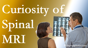Juneau MRIs for spinal stenosis may be revealing&hellip;or confusing.