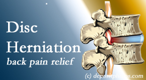 Aurora Chiropractic Center uses non-surgical treatment for relief of disc herniation related back pain. 