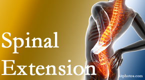 Aurora Chiropractic Center knows the role of extension in spinal motion, its necessity, its benefits and potential harmful effects. 