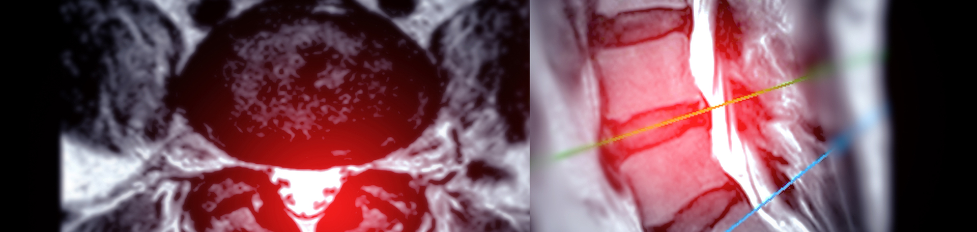 Juneau back pain imaging and exercise