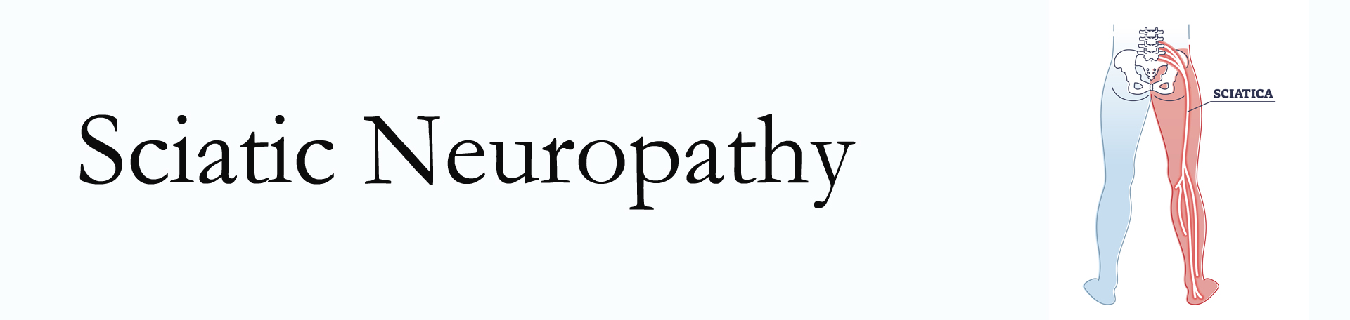 Juneau neuropathy pain (sciatica) 