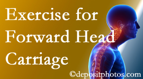 Juneau chiropractic treatment of forward head carriage is two-fold: manipulation and exercise.