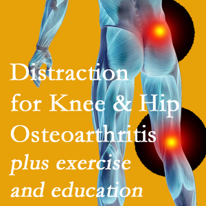 A chiropractic treatment plan for Juneau knee pain and hip pain due to osteoarthritis: education, exercise, distraction.