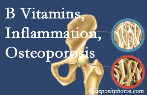 Juneau chiropractic care of osteoporosis usually comes with nutritional tips like b vitamins for inflammation reduction and for prevention.