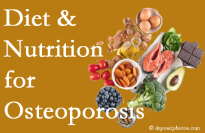 Juneau osteoporosis prevention tips from your chiropractor include improved diet and nutrition and reduced sodium, bad fats, and sugar intake. 