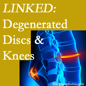 Degenerated discs and degenerated knees are not such strange bedfellows. They are seen to be related. Juneau patients with a loss of disc height due to disc degeneration often also have knee pain related to degeneration. 