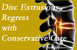 Juneau chiropractic care of extruded discs may benefit regression of them and improve your quality of life.
