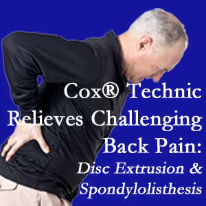 Juneau chiropractic care with Cox Technic alleviates back pain due to a painful combination of a disc extrusion and a spondylolytic spondylolisthesis.