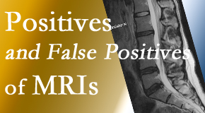 Aurora Chiropractic Center carefully chooses when and if MRI images are needed to guide the Juneau chiropractic treatment plan. 