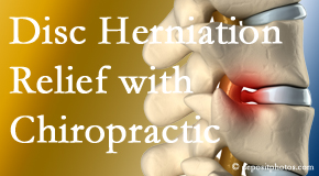 Aurora Chiropractic Center gently treats the disc herniation causing back pain. 
